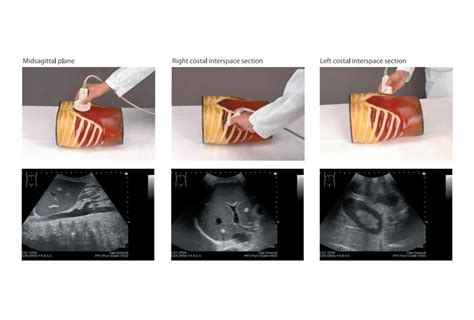 Ultrasound Exam Training Model Abdfan Set