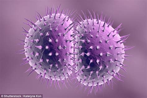 Gonorrhoea Superbug Is Rapidly Spreading Across The World Daily Mail