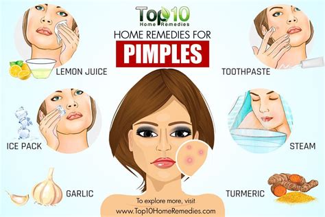 home remedies for pimples top 10 home remedies