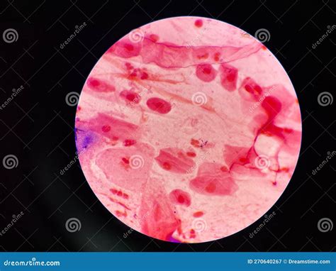 Bacteria Cell In Sputum Sample Gram Stain Method Stock Image Image Of