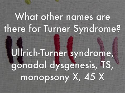 turner syndrome by mia park