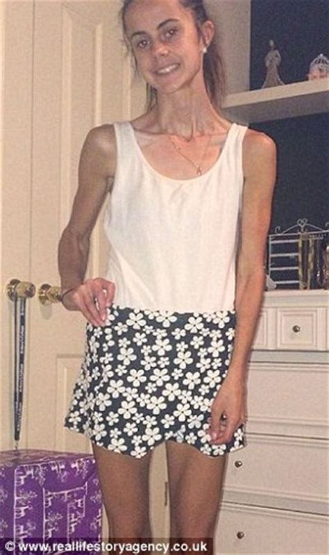 Blogger Documents Her Anorexia Recovery With Before And After Photos On