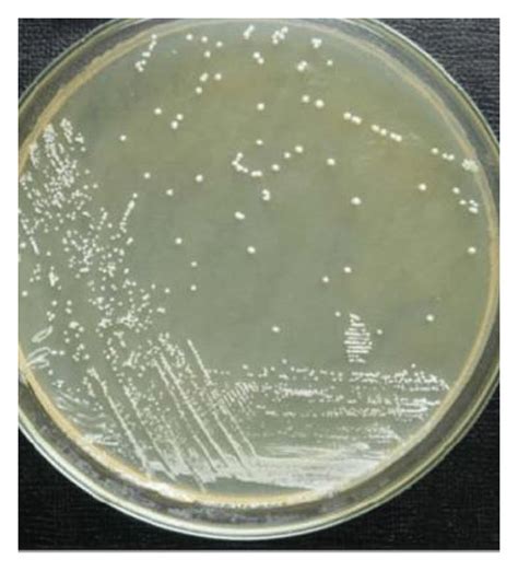 typical isolated colonies  lactobacillus spp   media
