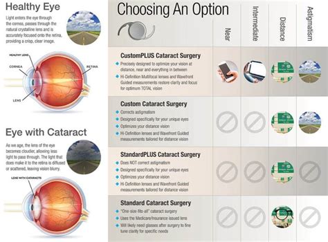 cataract surgery cataracts surgery center eye associates