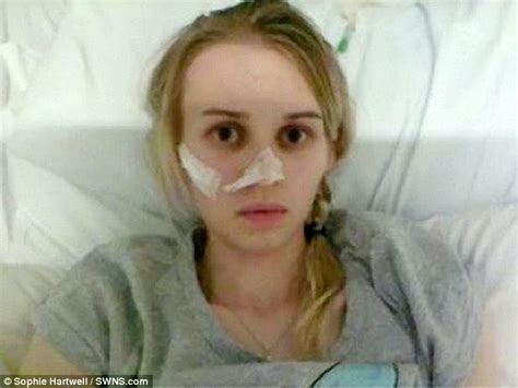 anorexic fears food so much she believes calories can be inhaled daily mail online