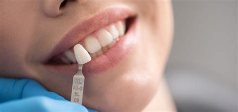 cost  tooth filling north york dental clinic