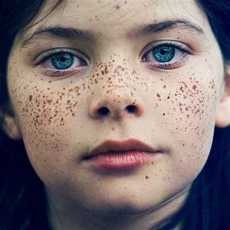 beautiful freckles freckles freckle face