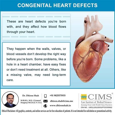 congenital heart defects   cardiac surgeon  ahmedabad