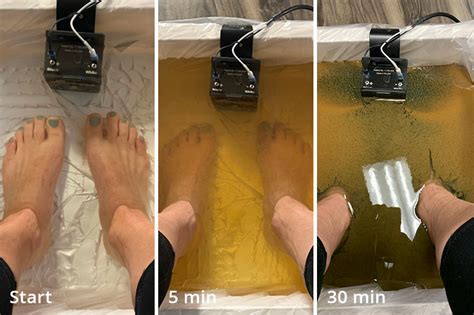 detox   ionic foot bath  healthy beginning
