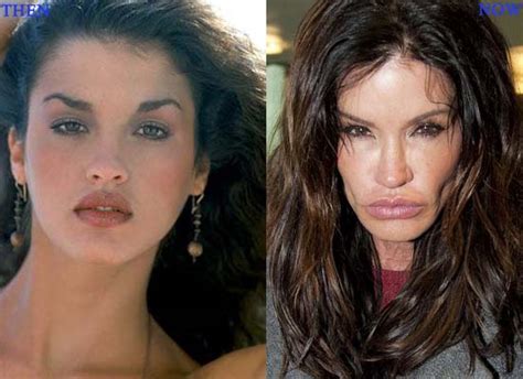 plastic surgery disasters stchd