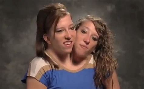 fascinating facts about famous conjoined twins abby and brittany hensel