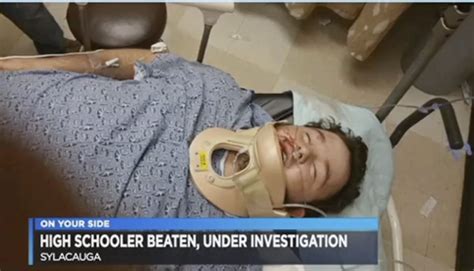 Alabama Teen Brutally Beaten By Group For Supporting Police