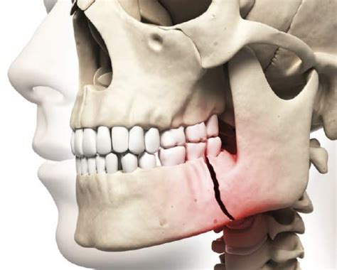 childrens dental concerns  injuries