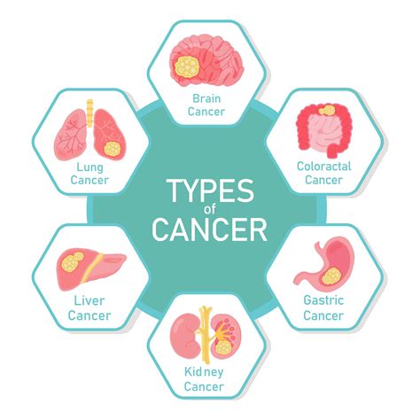 types  cancer diagram design  vector art  vecteezy
