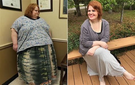 These ‘my 600 Lb Life’ Success Stories Will Blow Your