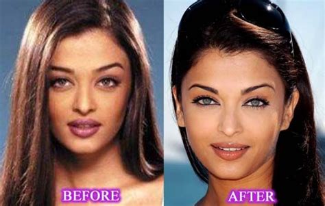 Aishwarya Rai Plastic Surgery Celebrity Before After