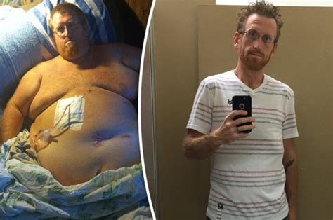 Man Makes Miraculous Weight Loss Transformation After 33st