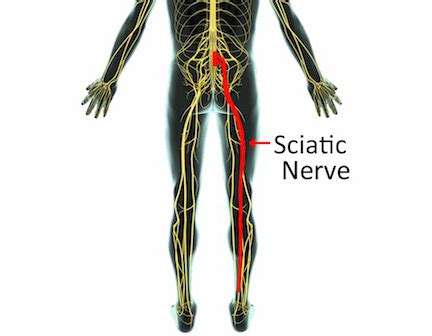 nerve pain quick fix sciatic nerve pain