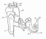 Patents Cochlear Implant Drawing sketch template