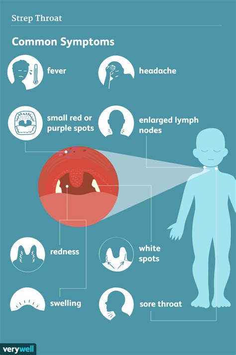 strep throat symptoms signs and complications