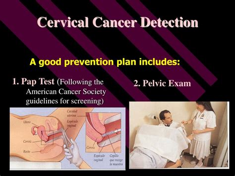 Ppt Cervical Cancer Powerpoint Presentation Free Download Id 4189864