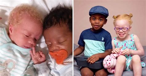 These Beautiful Twins Were Born Different Colours To The Absolute