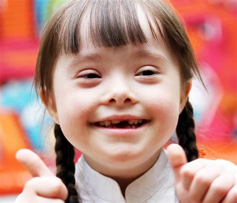 facts about down s syndrome