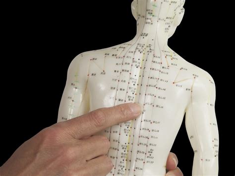 Akupunktur Mengobati Radang Sendi Cari Tahu Penjelasanya Di Sini