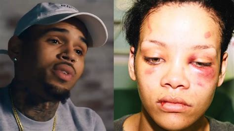 Chris Brown Details Rihanna Assault She Tried To Kick Me