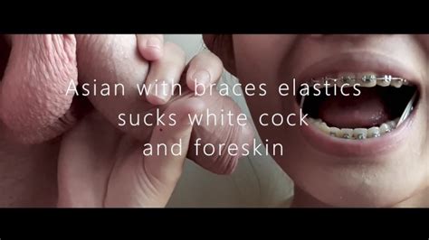 Asian With Braces Elastics Sucks White Cock And Foreskin Preview
