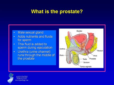 Sexual Life After Prostate Removal The Robotic Surgeon