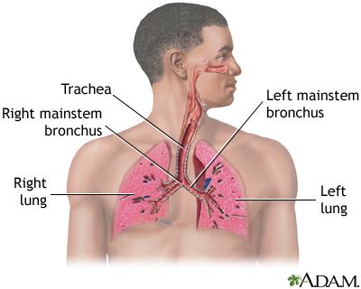 lung disease medlineplus medical encyclopedia