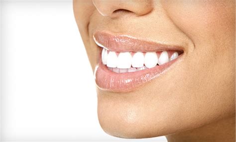 teeth whitening central park dental spa groupon