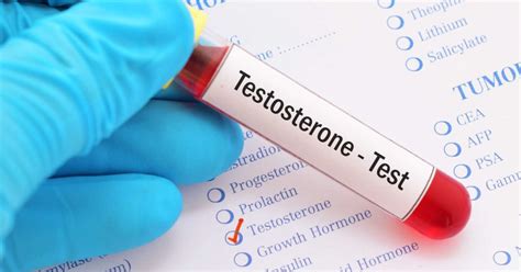 What Are Normal Testosterone Levels Ages Males Females And More
