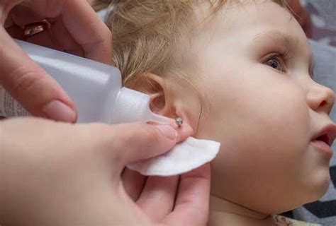 mengobati tindik telinga  bernanah  bayi yuk ketahui