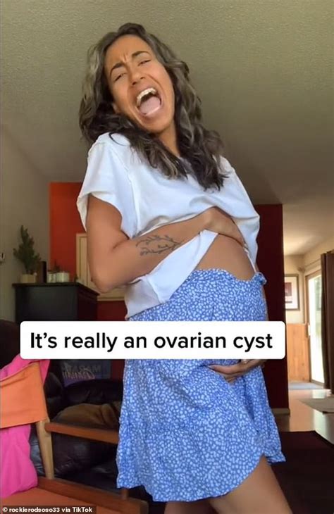 woman reveals ovarian cyst has made her look nine months pregnant