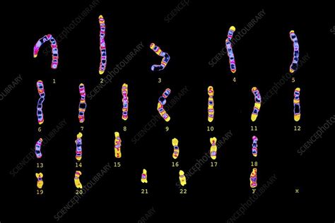 human sperm cell karyotype stock image c001 8362 science photo library