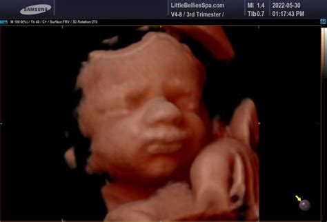 bellies ultrasound pregnancy spa orlando  eastgate dr