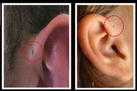 preauricular pit spiritual meaning