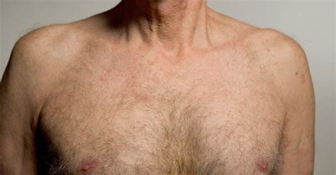 male breast cancer how to spot the symptoms plus what happens after