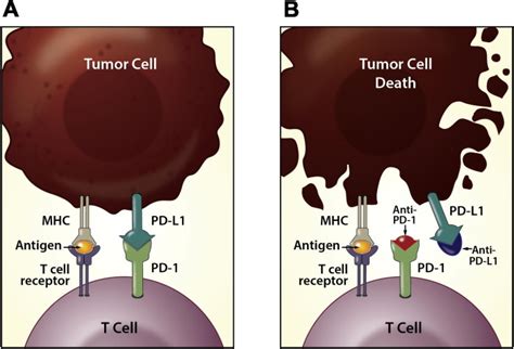 A Review On The Evolution Of Pd 1 Pd L1 Immunotherapy For Bladder