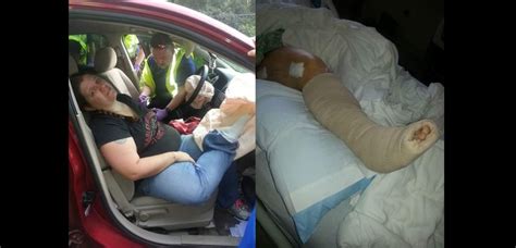 mom s horrific accident shows why you should never put your feet on the