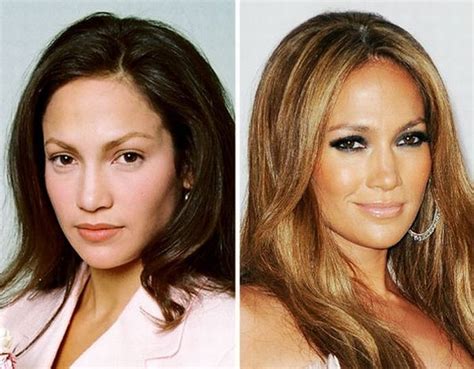Hbt Photos Celebrities Before And After Plastic Surgery