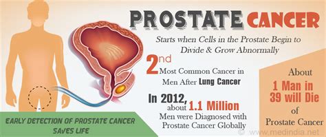 Pin On Prostate