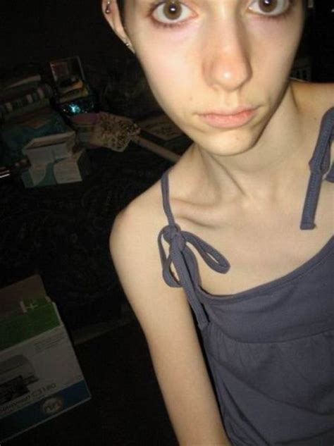 17 fotos mujeres con anorexia taringa