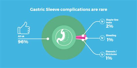 Gastric Sleeve Complications And Side Effects The 5 Most Common