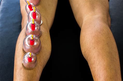anatomy cupping level 2 joints of the lower extremities november 10