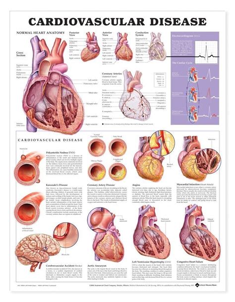 cardiovascular disease anatomical chart  edition cardiovascular