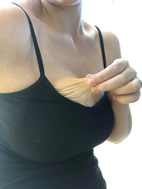 How To Get Rid Of Saggy Breasts After Weight Loss