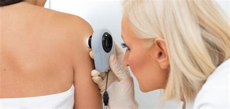 Whole Body Screening And Education In Melanoma Prone Families May